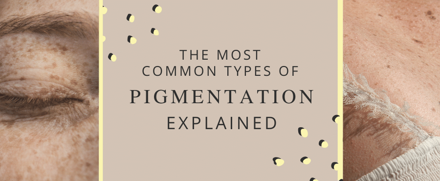 The most common types of pigmentation 